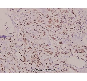 Anti-Lad (I249) Antibody from Bioworld Technology (BS9161) - Antibodies.com
