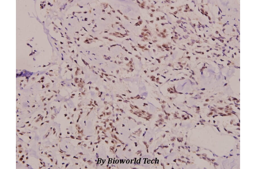 Anti-Lad (I249) Antibody from Bioworld Technology (BS9161) - Antibodies.com