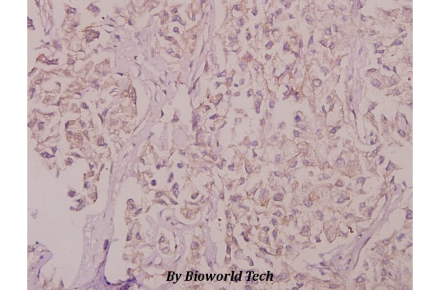 Anti-ZnT-1 (R239) Antibody from Bioworld Technology (BS9171) - Antibodies.com