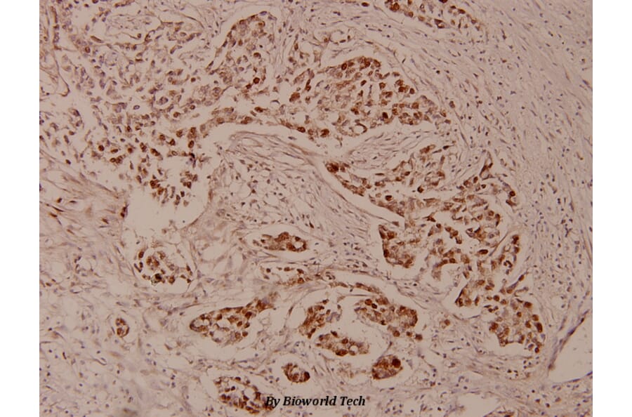 Anti-ZNF329 (D123) Antibody from Bioworld Technology (BS9172) - Antibodies.com