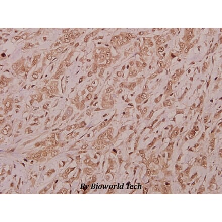 Anti-CSRNP2 (K127) Antibody from Bioworld Technology (BS9173) - Antibodies.com