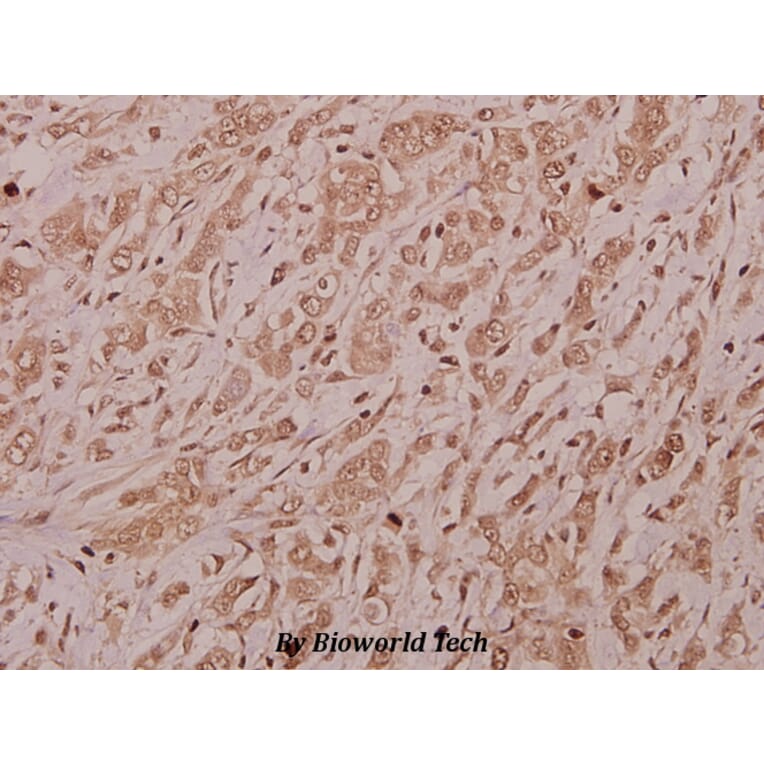 Anti-CSRNP2 (K127) Antibody from Bioworld Technology (BS9173) - Antibodies.com