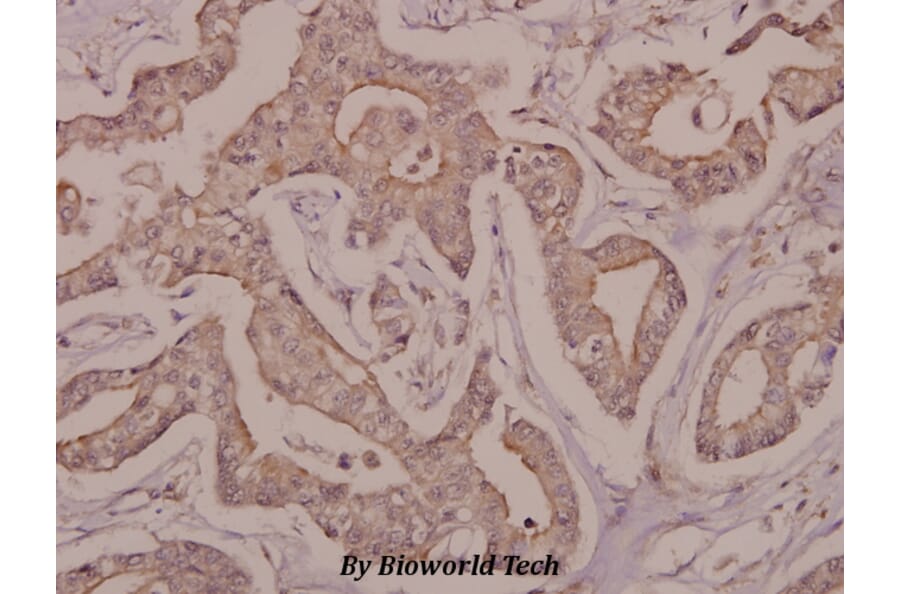 Anti-DRAK2 (I286) Antibody from Bioworld Technology (BS9183) - Antibodies.com