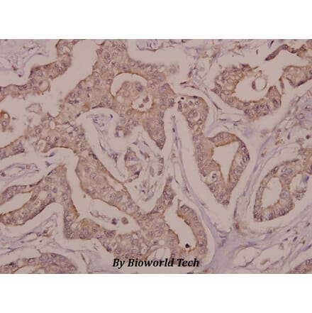 Anti-DRAK2 (I286) Antibody from Bioworld Technology (BS9183) - Antibodies.com