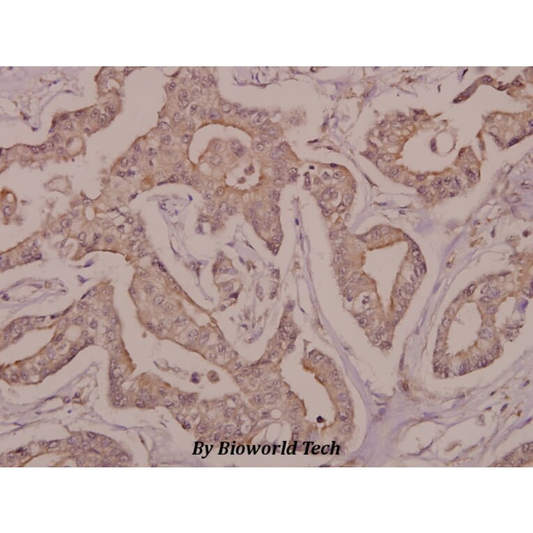 Anti-DRAK2 (I286) Antibody from Bioworld Technology (BS9183) - Antibodies.com