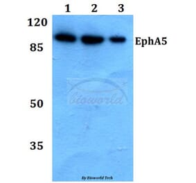 Anti-EphA5 (Y515) Antibody from Bioworld Technology (BS9185) - Antibodies.com