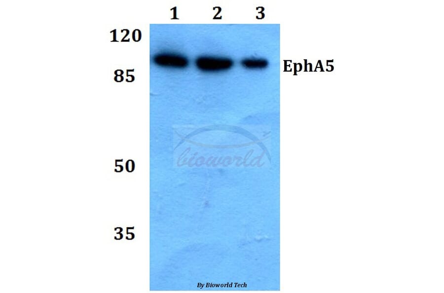 Anti-EphA5 (Y515) Antibody from Bioworld Technology (BS9185) - Antibodies.com