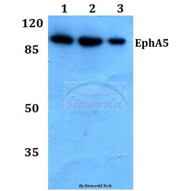 Anti-EphA5 (Y515) Antibody from Bioworld Technology (BS9185) - Antibodies.com