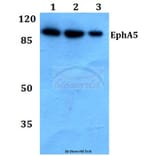 Anti-EphA5 (Y515) Antibody from Bioworld Technology (BS9185) - Antibodies.com