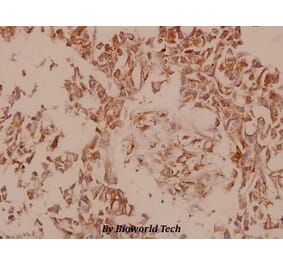 Anti-PAK5 (E693) Antibody from Bioworld Technology (BS9193) - Antibodies.com