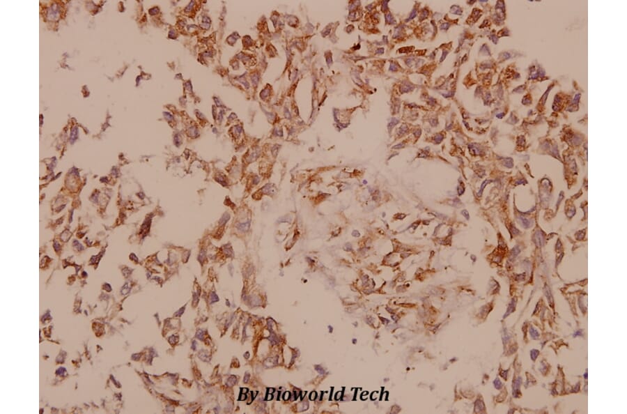 Anti-PAK5 (E693) Antibody from Bioworld Technology (BS9193) - Antibodies.com