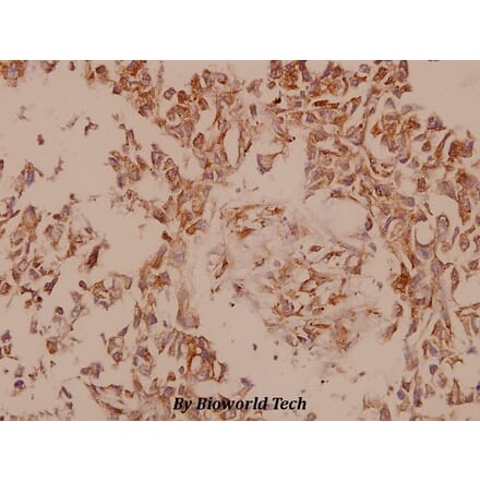 Anti-PAK5 (E693) Antibody from Bioworld Technology (BS9193) - Antibodies.com