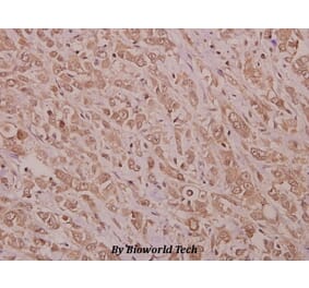 Anti-STK33 (N108) Antibody from Bioworld Technology (BS9197) - Antibodies.com