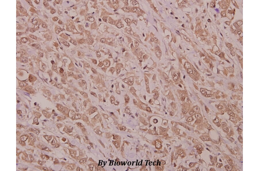 Anti-STK33 (N108) Antibody from Bioworld Technology (BS9197) - Antibodies.com