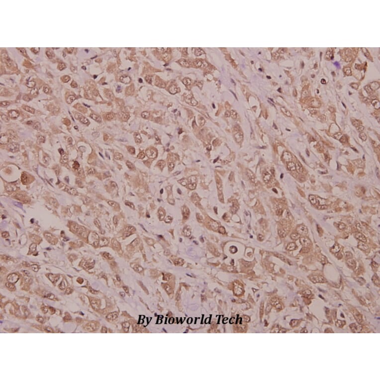 Anti-STK33 (N108) Antibody from Bioworld Technology (BS9197) - Antibodies.com