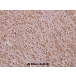 Anti-STK33 (N108) Antibody from Bioworld Technology (BS9197) - Antibodies.com