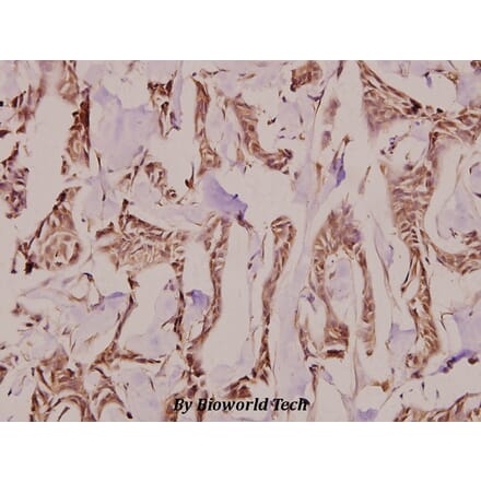 Anti-Follistatin (R163) Antibody from Bioworld Technology (BS9231) - Antibodies.com