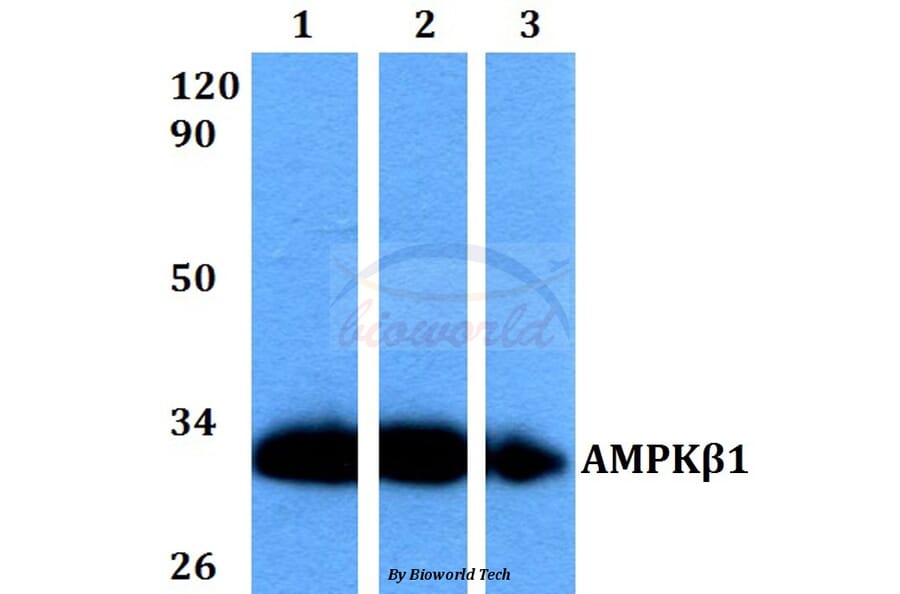 Anti-AMPKβ1 (V175) Antibody from Bioworld Technology (BS9234) - Antibodies.com