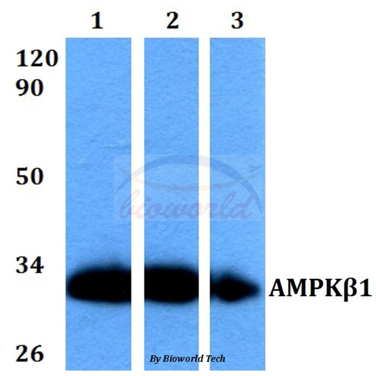 Anti-AMPKβ1 (V175) Antibody from Bioworld Technology (BS9234) - Antibodies.com