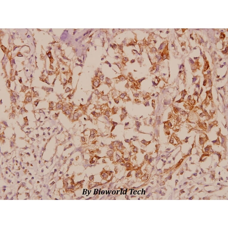 Anti-JIP-1 (A99) Antibody from Bioworld Technology (BS9237) - Antibodies.com