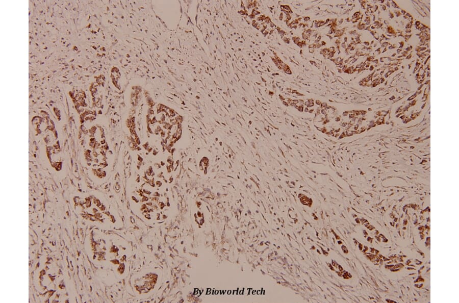 Anti-WAVE3 (D186) Antibody from Bioworld Technology (BS9244) - Antibodies.com