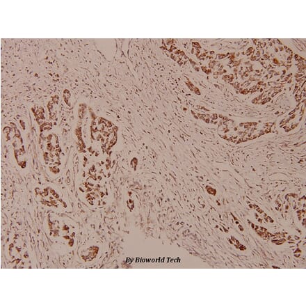 Anti-WAVE3 (D186) Antibody from Bioworld Technology (BS9244) - Antibodies.com