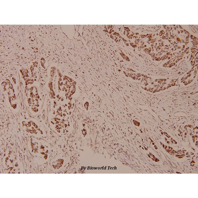 Anti-WAVE3 (D186) Antibody from Bioworld Technology (BS9244) - Antibodies.com