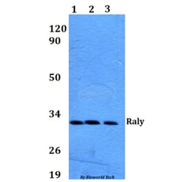 Anti-Raly (R103) Antibody from Bioworld Technology (BS9249) - Antibodies.com