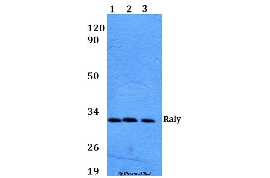 Anti-Raly (R103) Antibody from Bioworld Technology (BS9249) - Antibodies.com