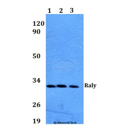 Anti-Raly (R103) Antibody from Bioworld Technology (BS9249) - Antibodies.com