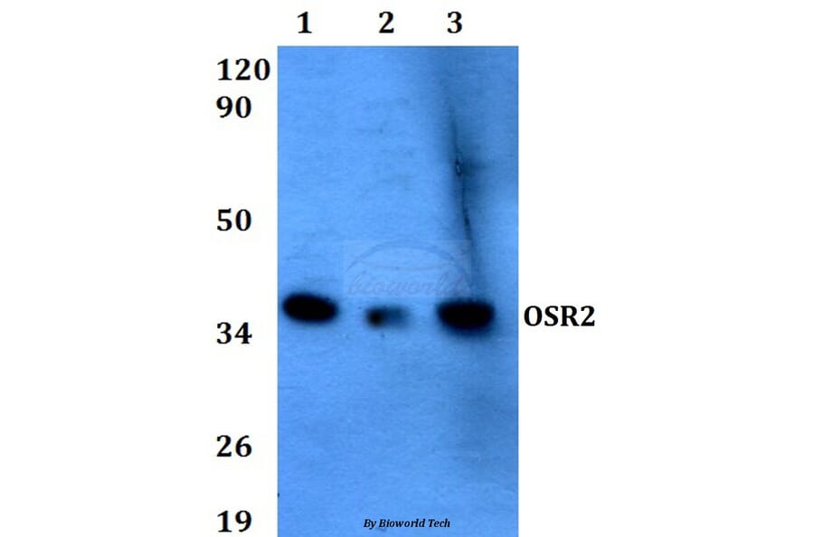 Anti-OSR2 (F118) Antibody from Bioworld Technology (BS9252) - Antibodies.com