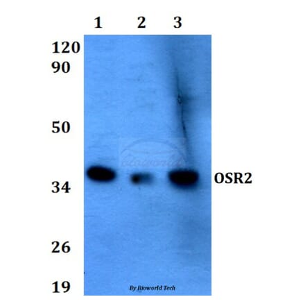 Anti-OSR2 (F118) Antibody from Bioworld Technology (BS9252) - Antibodies.com