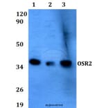 Anti-OSR2 (F118) Antibody from Bioworld Technology (BS9252) - Antibodies.com