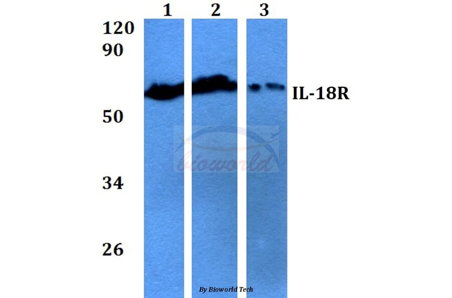 Anti-IL-18R (M270) Antibody from Bioworld Technology (BS9268) - Antibodies.com