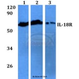 Anti-IL-18R (M270) Antibody from Bioworld Technology (BS9268) - Antibodies.com