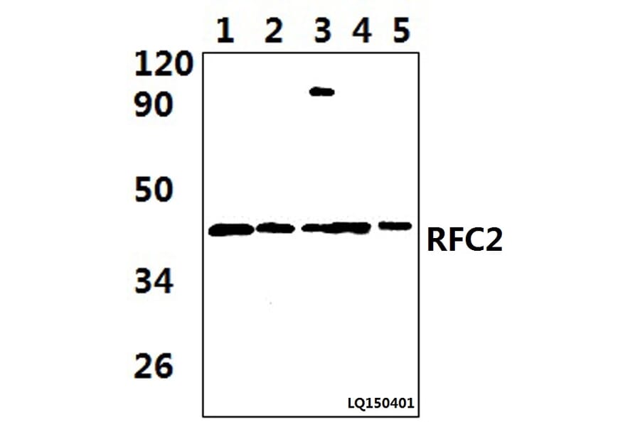 Anti-RFC2 (T165) Antibody from Bioworld Technology (BS9272) - Antibodies.com