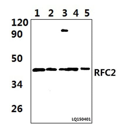Anti-RFC2 (T165) Antibody from Bioworld Technology (BS9272) - Antibodies.com
