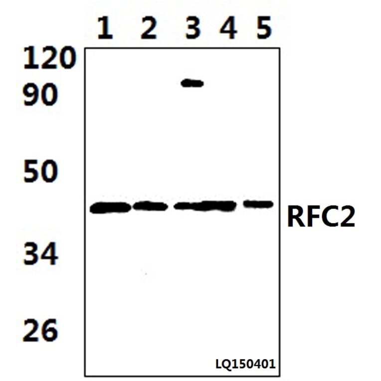 Anti-RFC2 (T165) Antibody from Bioworld Technology (BS9272) - Antibodies.com