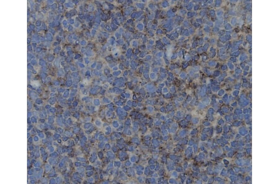 Anti-ZO1 Antibody from Bioworld Technology (BS9802M) - Antibodies.com