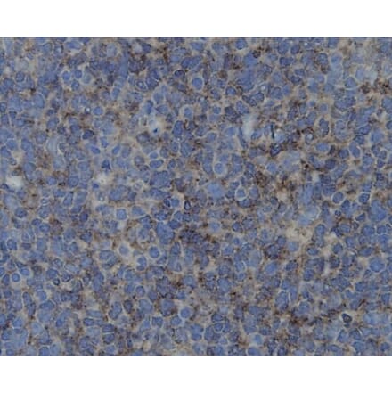 Anti-ZO1 Antibody from Bioworld Technology (BS9802M) - Antibodies.com