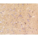 Anti-LRP1 Antibody from Bioworld Technology (BS9805M) - Antibodies.com