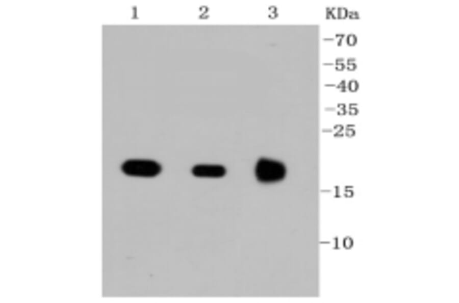Anti-Ras Antibody from Bioworld Technology (BS9812M) - Antibodies.com