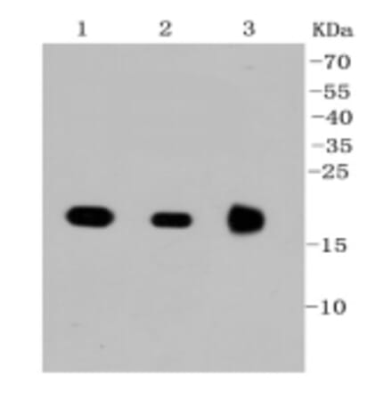 Anti-Ras Antibody from Bioworld Technology (BS9812M) - Antibodies.com
