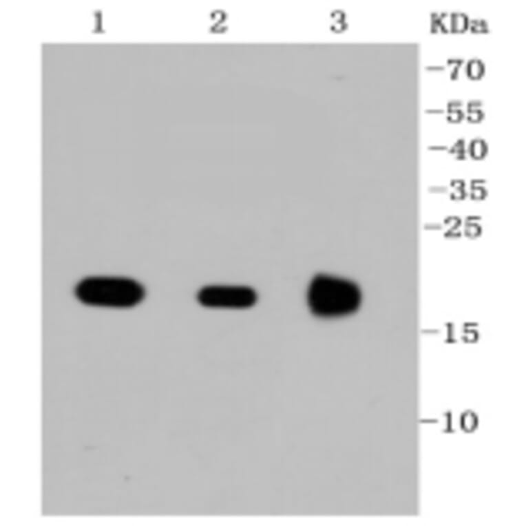 Anti-Ras Antibody from Bioworld Technology (BS9812M) - Antibodies.com