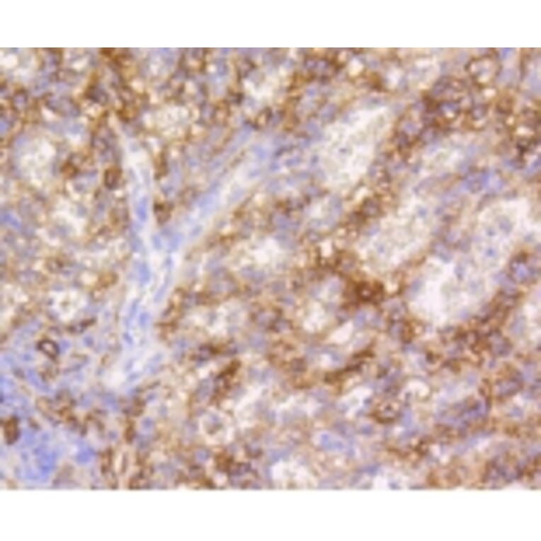 Anti-VCAM1 Antibody from Bioworld Technology (BS9814M) - Antibodies.com