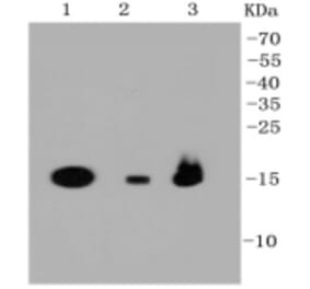 Anti-PBR Antibody from Bioworld Technology (BS9815M) - Antibodies.com