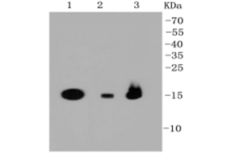Anti-PBR Antibody from Bioworld Technology (BS9815M) - Antibodies.com