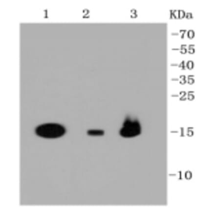 Anti-PBR Antibody from Bioworld Technology (BS9815M) - Antibodies.com