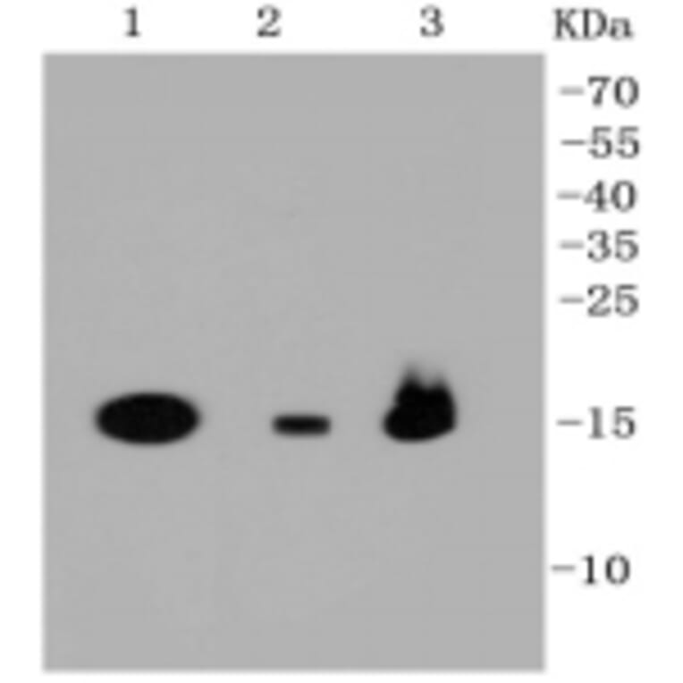 Anti-PBR Antibody from Bioworld Technology (BS9815M) - Antibodies.com