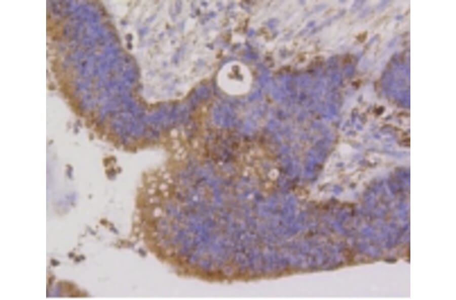 Anti-PBR Antibody from Bioworld Technology (BS9815M) - Antibodies.com